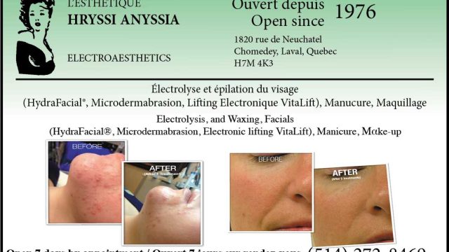 HRYSSI ANNYSIA